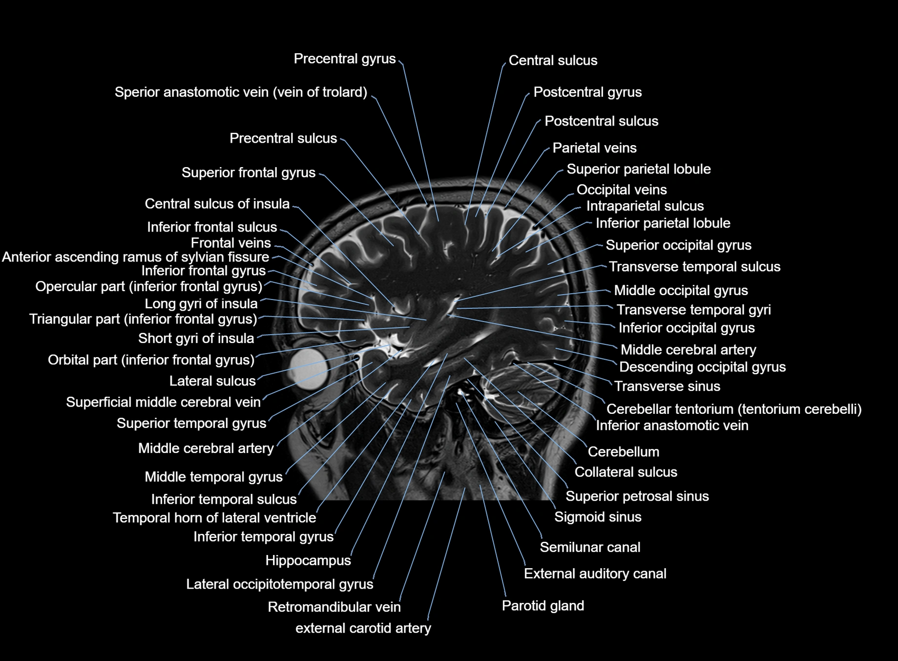 brain sagittal anatomy 3T MRI images -img-00001-00017.webp